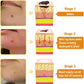 Bee Venom Skin Treatment Cream,Repair Maximum Strength for All Skin Types (2PCS)