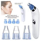 Derma Suction Vacuum Skin Cleanser | 4 in 1 Multi-function Blackhead Remover Tool | Remover Kit Skin Cleaner | Pimple Removal Tool | Ane Removal Tool